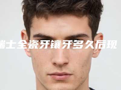 瑞士全瓷牙镶牙多久后现有明显效果