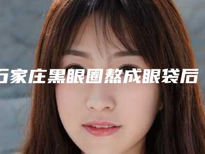 石家庄黑眼圈熬成眼袋后会不会有不良反应