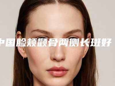 中国脸颊颧骨两侧长斑好点的医院:脸颊颧骨两侧长斑医院前50全新排序