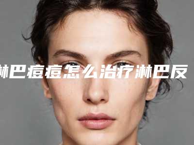 淋巴痘痘怎么治疗淋巴反复长痘痘怎么办