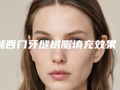 湘西门牙缝树脂填充效果能维持多长时间啊