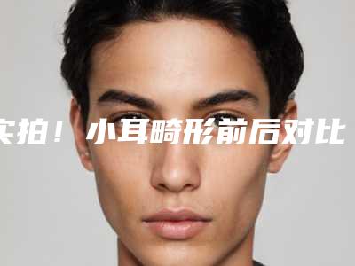 实拍!小耳畸形前后对比图(小耳畸形是什么样子)