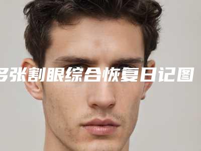 多张割眼综合恢复日记图,揭晓韩国DI整形医院到底技术怎样