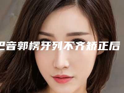 巴音郭楞牙列不齐矫正后能维持多长时间