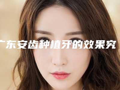 广东安齿种植牙的效果究竟如何