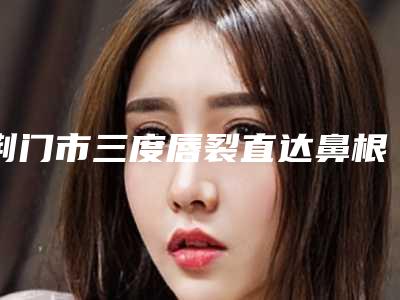 荆门市三度唇裂直达鼻根医院在榜清单名单发布(荆门市三度唇裂直达鼻根整形医院)