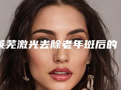 莱芜激光去除老年斑后的3项护理要点