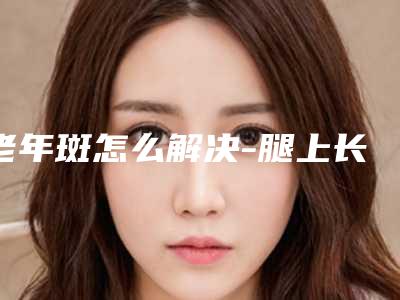 老年斑怎么解决-腿上长了类似老年斑的东西