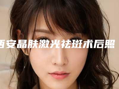 西安晶肤激光祛斑术后照片对比图
