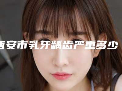 西安市乳牙龋齿严重多少钱-西安市乳牙龋齿严重医院排名前四权威点评