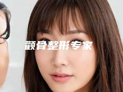 颧骨整形专家