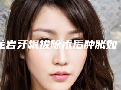 龙岩牙根拔除术后肿胀如何处理