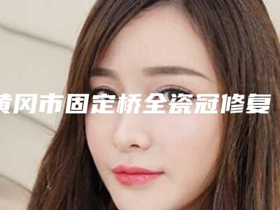 黄冈市固定桥全瓷冠修复医生在榜名单你比较中意吗-黄冈市固定桥全瓷冠修复口腔医生